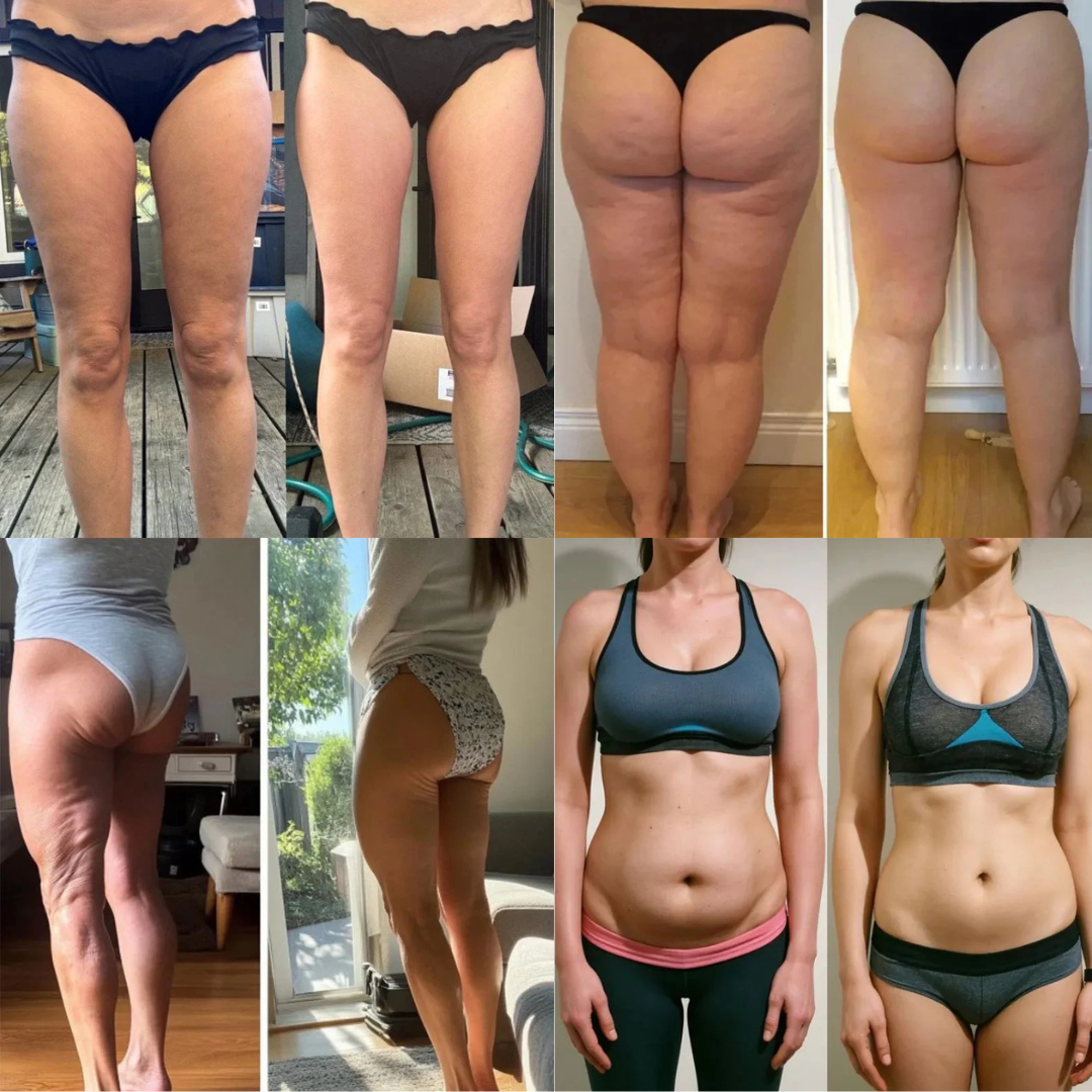 ACE™ Anti-Cellulite Massager