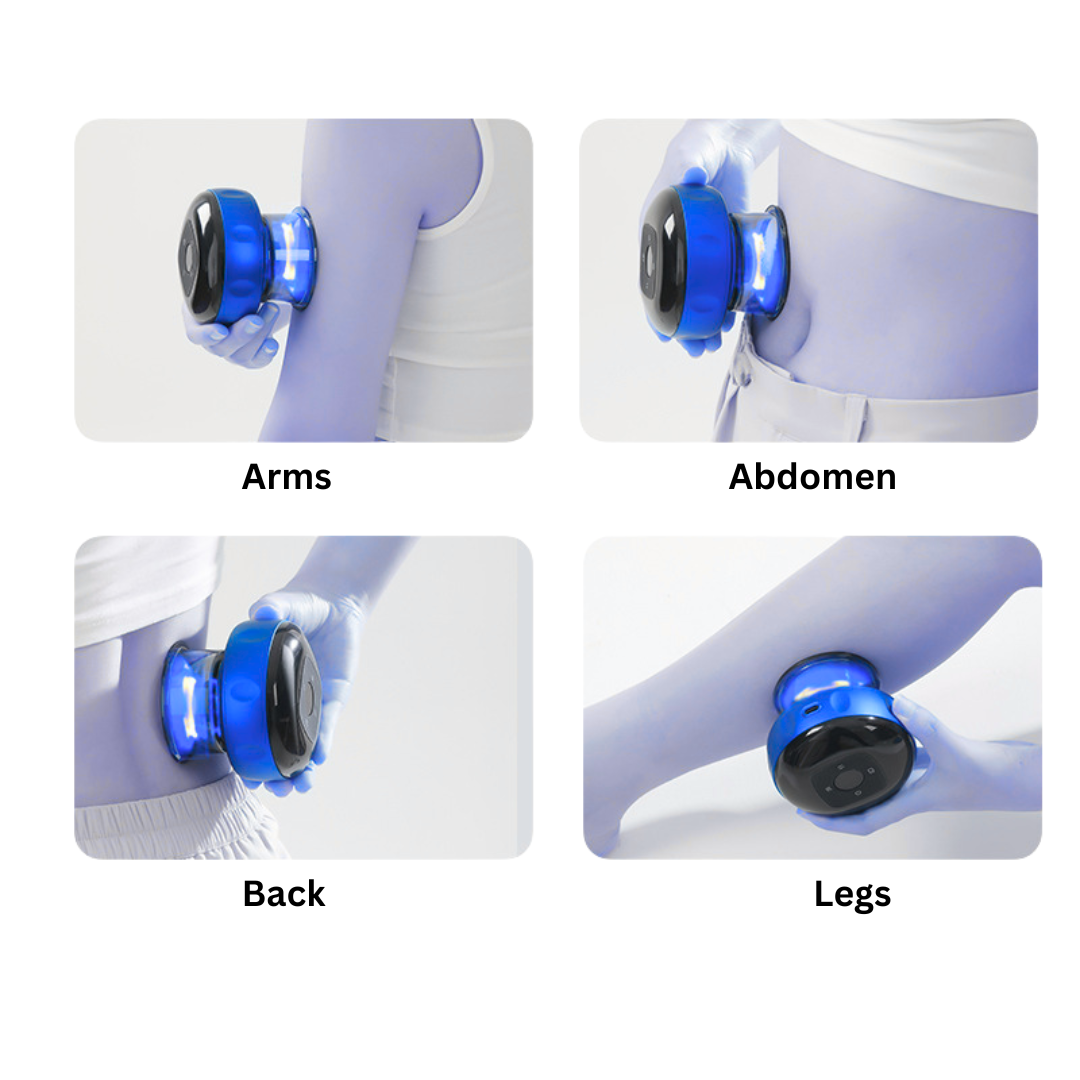 ACE™ Smart Cupping Massager