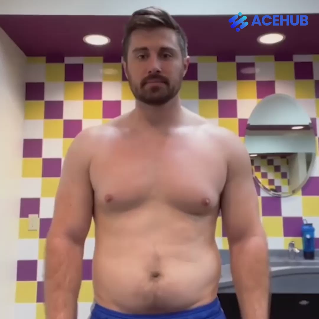 ACE™ Muscle Stimulator video